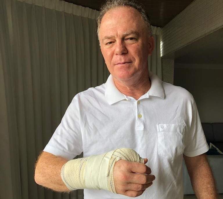 Casagrande cai jogando futebol e passa por cirurgia na mão