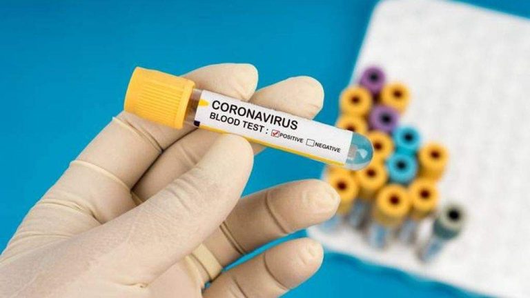 Número de óbitos por coronavírus no ES sobe para 2.256; Vila Velha é a cidade com mais infectados