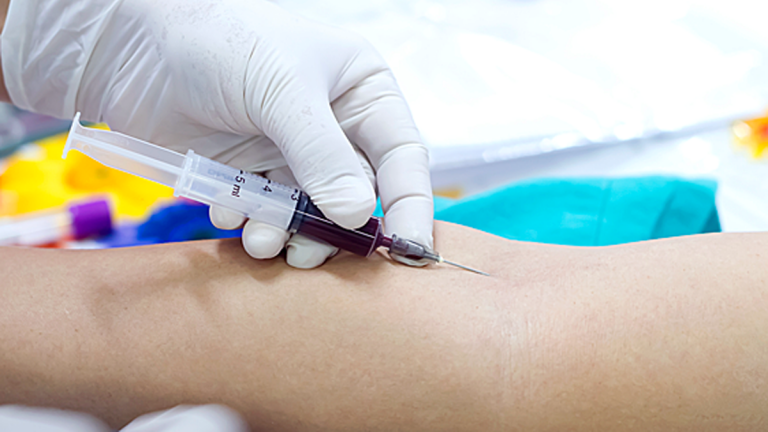 Secretaria de Saúde de Mimoso realiza coleta de sangue para exame de hemoglobina glicada de todos os diabéticos