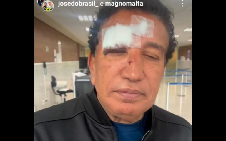 Magno Malta aparece com olho roxo e nariz quebrado: “Escorregou no banheiro”