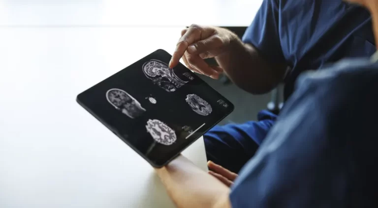 Novos testes de laboratório podem acelerar diagnóstico e a pesquisa de Parkinson